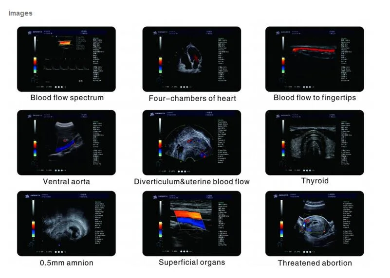 Medical Diagnosis Equipment Cardiac Color Doppler Portable 4D Ultrasound Scanner